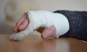 Jak długo trwa rehabilitacja po złamaniu nadgarstka? Sprawdź, co wpływa na czas powrotu do zdrowia