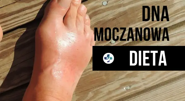 Dna moczanowa: Skuteczna dieta niskopurynowa jedz bez bólu!
