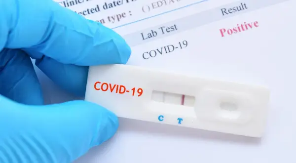 Jak zapisać się na test COVID? NFZ i prywatnie krok po kroku