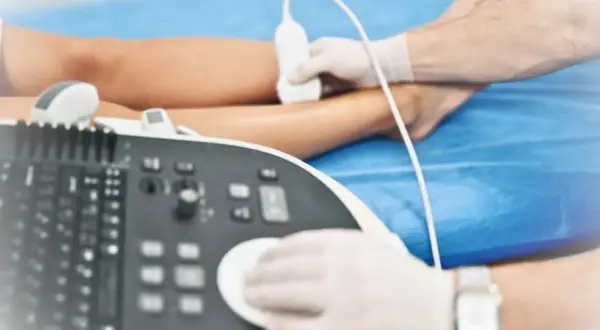 USG Doppler żył NFZ: Jak uzyskać badanie krok po kroku?