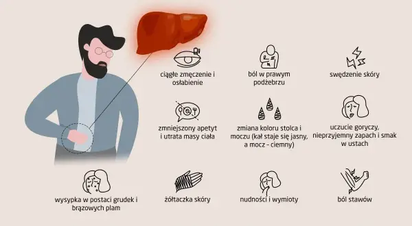 Objawy zapalenia wątroby: Kiedy to coś więcej niż zmęczenie?