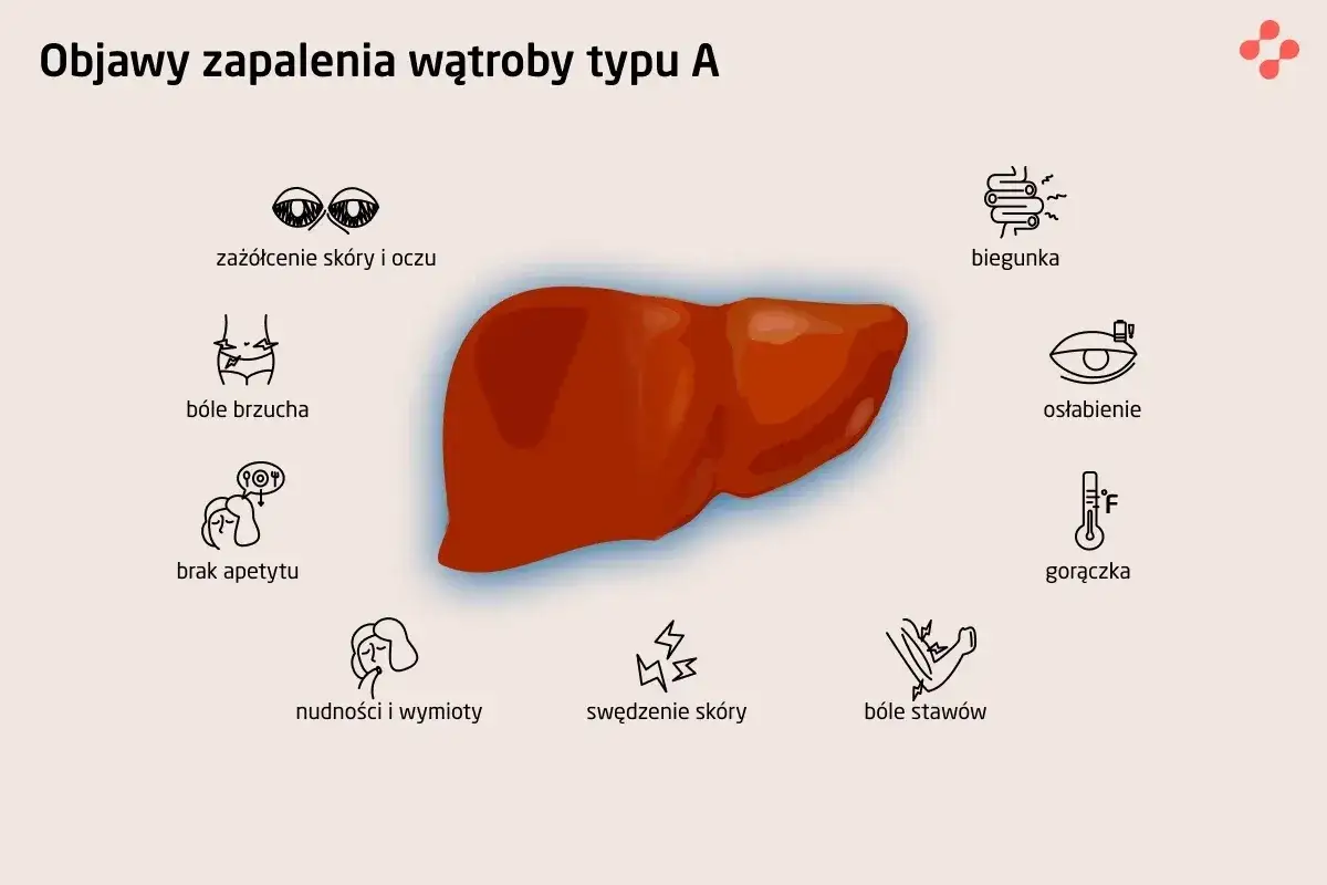 objawy wirusowego zapalenia wątroby WZW A B C