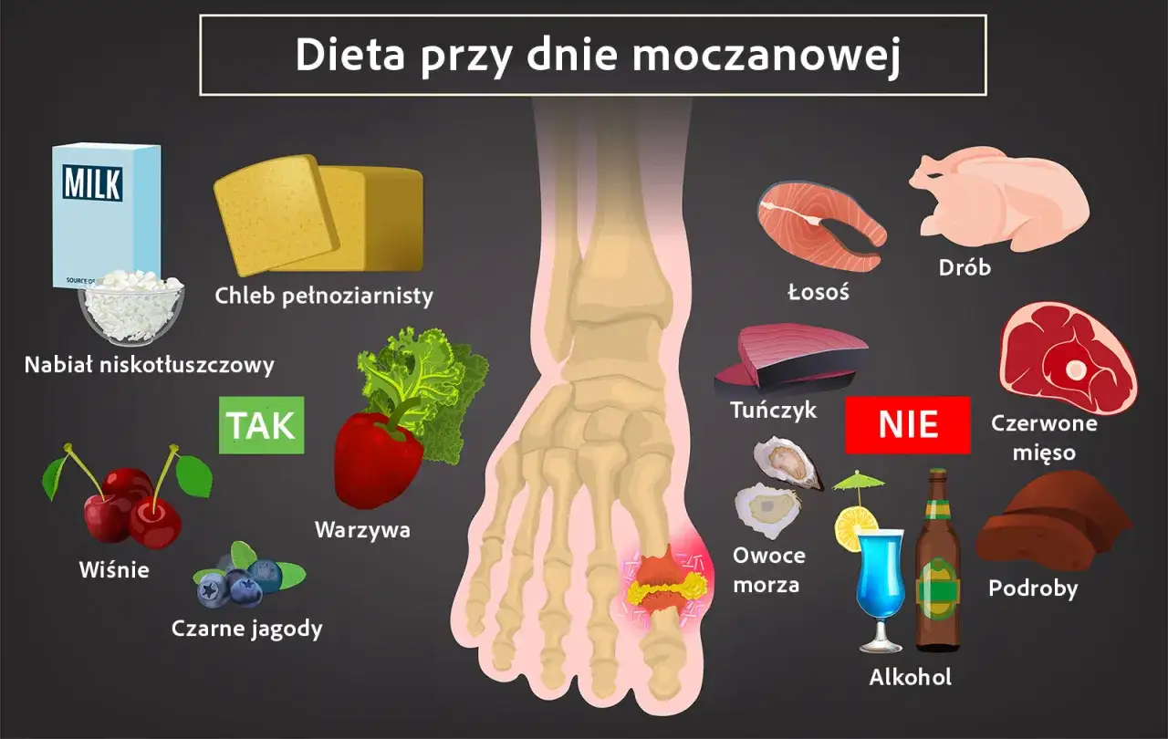 Dieta w dnie moczanowej tabela produktów