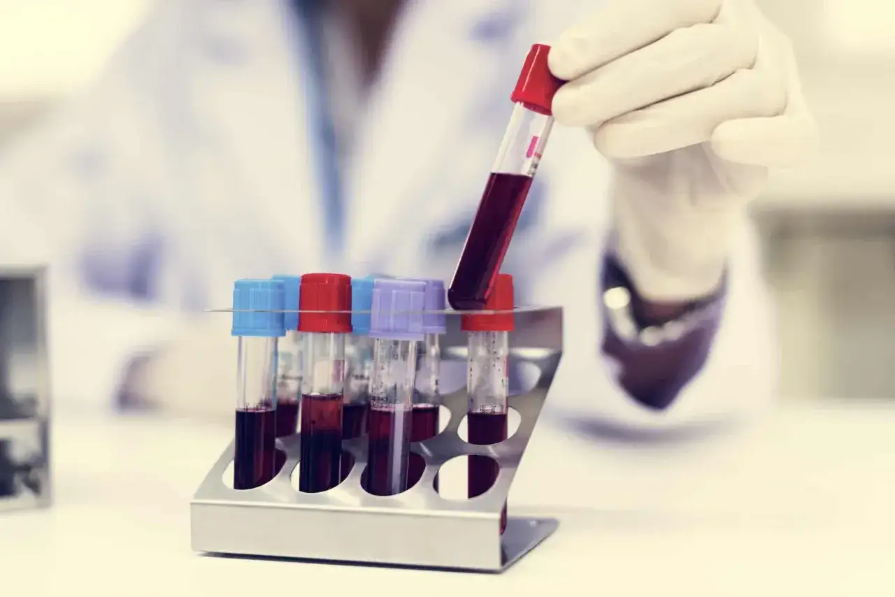 laboratorium medyczne, probówki z krwią