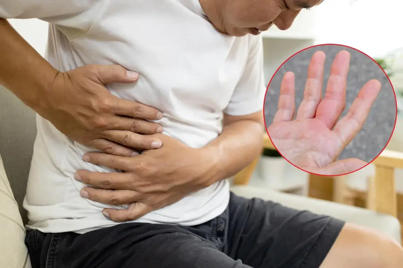 nietypowe objawy chorej wątroby skóra i neurologia