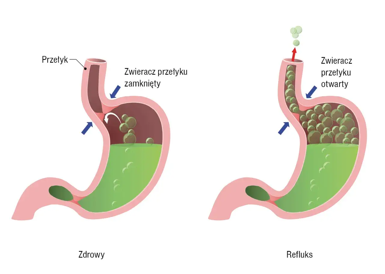anatomia przełyku i refluks