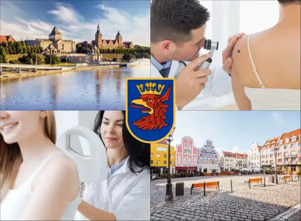 Kolaż: widok na Szczecin, dermatolog badający znamię, lekarz badający skórę pacjentki, herb Szczecina, kolorowe kamienice.
